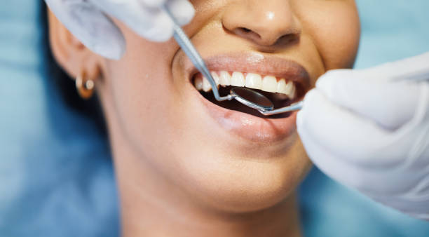 Best Emergency Treatment for Dental Infections or Abscesses in Burleson, TX
